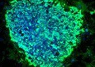 Characterization Characterization