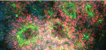 Differentiated NSCs grown in Gibco Essential 6 Medium Differentiated NSCs grown in Gibco Essential 6 Medium