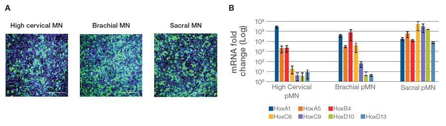 Differentiated motor neurons grown in Gibco Essential 6 Medium and graph showing expression profiles indicative of motor neuron progenitors Differentiated motor neurons grown in Gibco Essential 6 Medium and graph showing expression profiles indicative of motor neuron progenitors