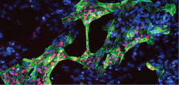 Differentiated cardiomyocytes grown in Gibco Essential 6 Medium Differentiated cardiomyocytes grown in Gibco Essential 6 Medium