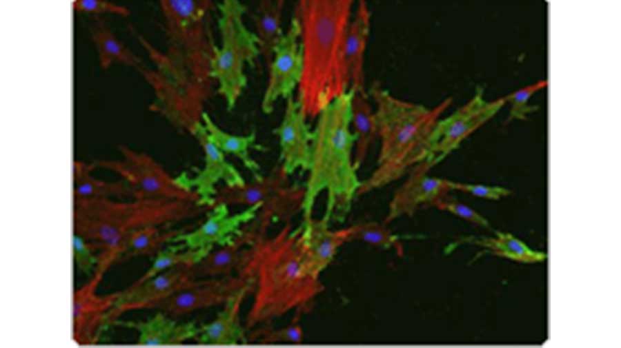 MSC Analysis product photo of StemPro Chondrogenesis Differentiation Kit