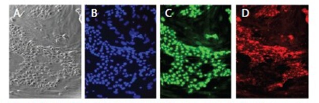 hESCs cultured in KnockOut SR XenoFree Medium retain their pluripotent phenotype phase contrast microscopy images of BG01v cells showing expression of DAPI, Oct4, and SSEA4