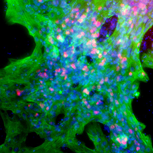 Differentiated cardiomyocytes express NKX2.5 and TNNT2/cTNT markers fluorescence microscopy of cardiomyocytes stained for NKX2.5 (red), TNNT2/cTNT (green), and DAPI nuclear DNA counterstaining (blue)