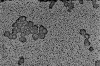 Influenza virus imaged with SEM Influenza virus imaged with SEM