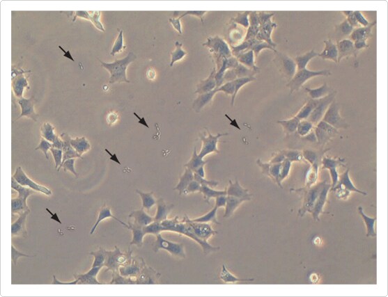 293 cells contaminated with yeast Simulated phase contrast image of yeast contamination in cell culture of 293 cells
