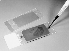 fluorescence-microscopy.par.56907.image.275.206.1.s001316-hybridization-gif fluorescence-microscopy.par.56907.image.275.206.1.s001316-hybridization-gif
