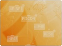 showcase.par.73799.image.0.0.1 Gel Electrophoresis Sample Preparation