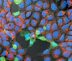 Apoptosis protocols Confluent cells stained green, orange and blue fluorescence