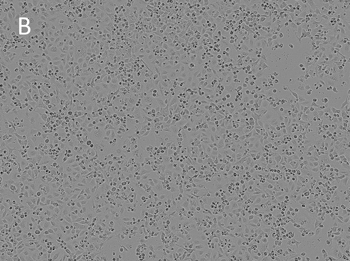 Posttransfection analysis of A549 bright-field cells Posttransfection analysis of A549 bright-field cells