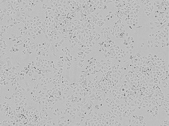 Brightfield image of A549 cells in culture Brightfield image of A549 cells in culture