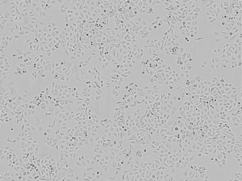 Brightfield image of A549 cells in culture Brightfield image of A549 cells in culture