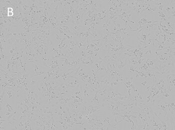 Posttransfection analysis of Calu-1 cells bright-field images Posttransfection analysis of Calu-1 cells bright-field images
