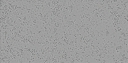 Calu-3 Cells Using Lipofectamine 3000 Reagent Calu-3 Cells Using Lipofectamine 3000 Reagent