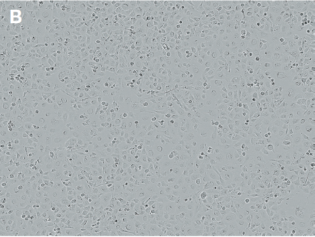 bright-field images demonstrating 60–66% transfection efficiency bright-field images demonstrating 60–66% transfection efficiency