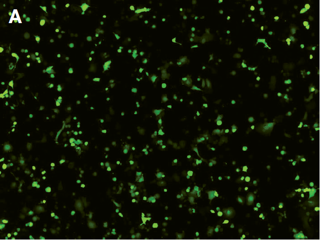 Post-transfection analysis of cells (Fluorescence) Post-transfection analysis of cells (Fluorescence)