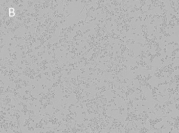 Posttransfection analysis of Calu-6 cells bright-field images Posttransfection analysis of Calu-6 cells bright-field images