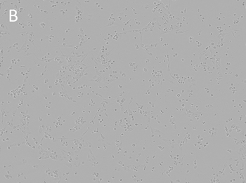 Posttransfection analysis of D17 cells bright-field Posttransfection analysis of D17 cells bright-field