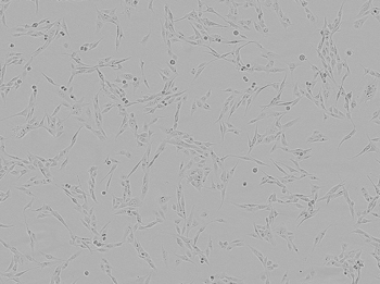 Brightfield image of D17 cells in culture prior to transfection Brightfield image of D17 cells in culture prior to transfection