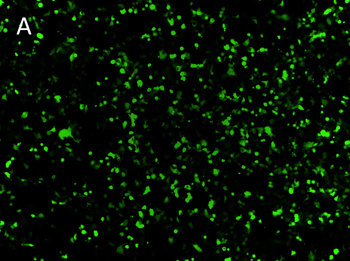 Posttransfection analysis of hepa 16 fluorescence cells Posttransfection analysis of hepa 16 fluorescence cells