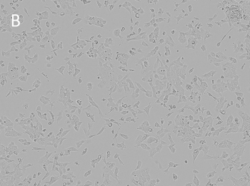 Posttransfection analysis of hepa 16 bright-field cells Posttransfection analysis of hepa 16 bright-field cells