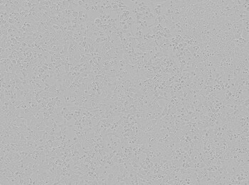 Brightfield image of Hepa16 cells in culture, prior to transfection Brightfield image of Hepa16 cells in culture, prior to transfection