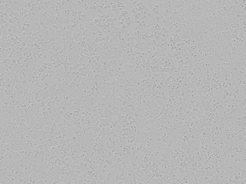 Brightfield image of Hepa16 cells in culture, prior to transfection Brightfield image of Hepa16 cells in culture, prior to transfection