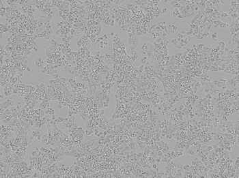 Transfecting plasmid DNA into HepG2 cells Transfecting plasmid DNA into HepG2 cells