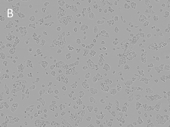Posttransfection analysis of bright-fields cells Posttransfection analysis of bright-fields cells