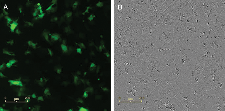 Post-transfection analysis of cell Post-transfection analysis of cell