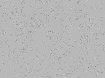 Brightfield image of JC cells in culture prior to transfection Brightfield image of JC cells in culture prior to transfection