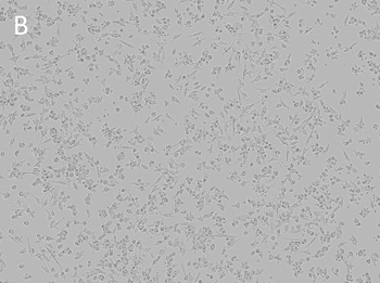 Posttransfection analysis of JC cells bright-field images Posttransfection analysis of JC cells bright-field images