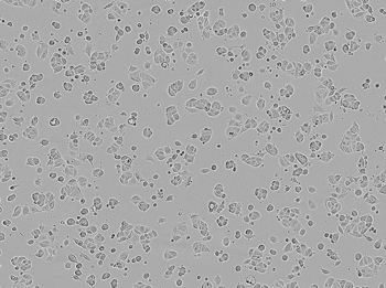 Brightfield image of MCF7 cells in culture Brightfield image of MCF7 cells in culture