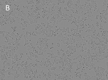 Posttransfection analysis of bright-field cells Posttransfection analysis of bright-field cells