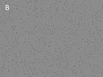 Posttransfection analysis of bright-field cells Posttransfection analysis of bright-field cells