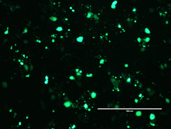 Posttransfection analysis of MDA-MB-468 cells Posttransfection analysis of MDA-MB-468 cells