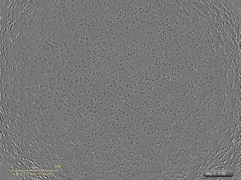 Brightfield image of MDAMB468 cells in culture, prior to transfection. Brightfield image of MDAMB468 cells in culture, prior to transfection.