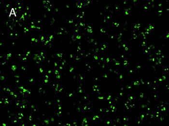 Posttransfection analysis of MOR cells fluorescence images Posttransfection analysis of MOR cells fluorescence images