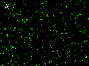 Posttransfection analysis of MOR cells fluorescence images Posttransfection analysis of MOR cells fluorescence images
