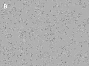 Posttransfection analysis of MOR cells bright-field images Posttransfection analysis of MOR cells bright-field images