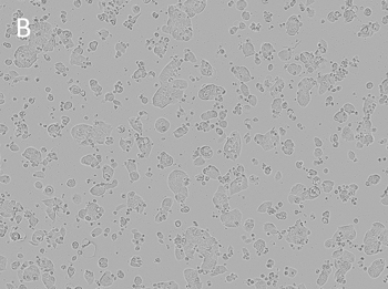 Posttransfection analysis of MOR cells bright-field images Posttransfection analysis of MOR cells bright-field images