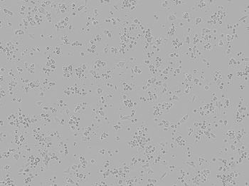 Brightfield image of MOR cells in culture prior to transfection Brightfield image of MOR cells in culture prior to transfection