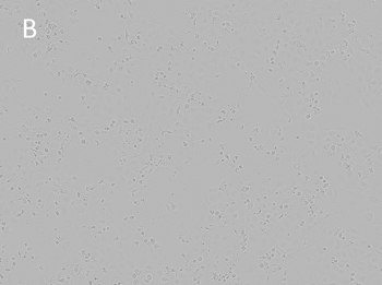 NCI-H1650-BF NCI-H1650-BF