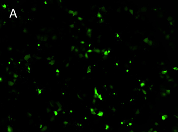 NCI-H1650-GFP NCI-H1650-GFP