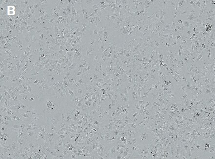 Bright-field images demonstrating 49% transfection efficiency Bright-field images demonstrating 49% transfection efficiency