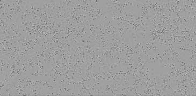 Brightfield image of NCI-H23 cells in culture, prior to transfection. Brightfield image of NCI-H23 cells in culture, prior to transfection.