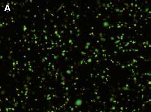 Fluorescence image demonstrating 51% transfection efficiency Fluorescence image demonstrating 51% transfection efficiency