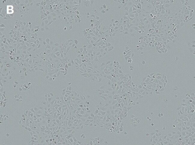 bright-field image demonstrating 12–14% transfection efficiency bright-field image demonstrating 12–14% transfection efficiency