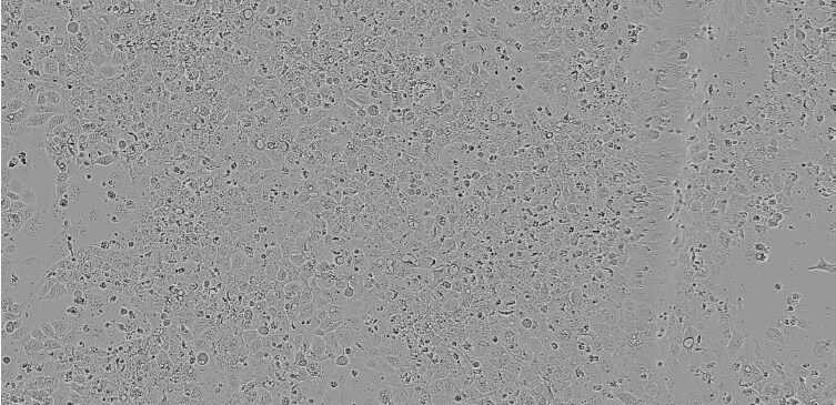 Brightfield image of NCI-H292 cells in culture, prior to transfection Brightfield image of NCI-H292 cells in culture, prior to transfection