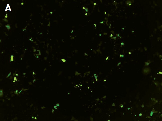 Fluorescence image demonstrating 12–14% transfection efficiency Fluorescence image demonstrating 12–14% transfection efficiency