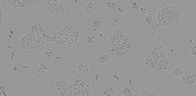 Brightfield image of NCI-H358 cells in culture, prior to transfection Brightfield image of NCI-H358 cells in culture, prior to transfection
